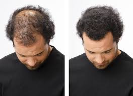 ولكن ليست كل قصة أو تسريحة تناسب مختلف الوجوه، فأنا أحتاج اختيار تسريحات شعر. Ù…Ù‡Ù…Ø© ÙƒÙŠÙ†Øª Ø²Ù…ÙŠÙ„ Ø§ÙØ¶Ù„ Ø¹Ù„Ø§Ø¬ Ù„Ù„Ø´Ø¹Ø± Ø§Ù„Ø®ÙÙŠÙ Ù„Ù„Ø±Ø¬Ø§Ù„ Findlocal Drivewayrepair Com