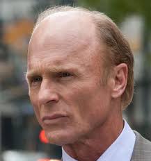 Many Use the Lack of a Mole