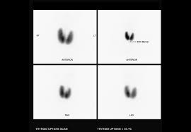 We did not find results for: Graves Disease Radiology Case Radiopaedia Org