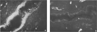 Immunofluorescent localization of the acid-stable proteinase inhibitor  (antileukoprotease) of human cervical mucus