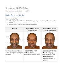 Unlike a stroke, however, bell's palsy usually gets better on its own after a few weeks, according to webmd. Https Www Psychdb Com Media Neurology Approaches Stroke Vs Bells Palsy Pdf