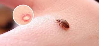 Pest control professionals will charge by the room, by the total square footage, or give you a flat fee, but most infestations will require more than one visit. Bed Bugs Control Melbourne Bed Bugs Treatment 0448 955 555