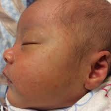 疹| 媽咪拜MamiBuy