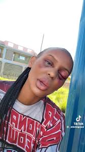 Huyu amesema bwana ya wenyewe hatawai karibia tena .Pole sana and quick  recovery