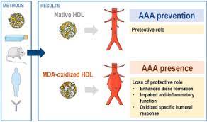 Malondialdehyde-modified HDL particles elicit a specific IgG response in  abdominal aortic aneurysm - ScienceDirect