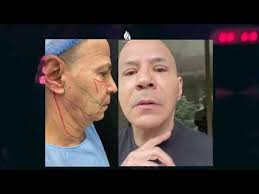 Dr Nora Stanford Plastic Surgery