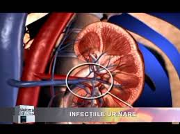 Săpunurile, loțiunile și gelurile de duș parfumate pot irita țesutul sensibil din. Infectiile Urinare Diagnostic Si Tratament La Clinica Somesan Youtube