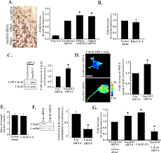 Cdc42 is a member of the rho gtpase family that regulates multiple cellular activities, including actin. Differential Regulation Of Rho Gtpases During Lung Adenocarcinoma Migration And Invasion Reveals A Novel Role Of The Tumor Suppressor Stard13 In Invadopodia Regulation Cell Communication And Signaling Full Text