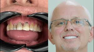 Home » Freer Dental Aesthetic and Implants Center