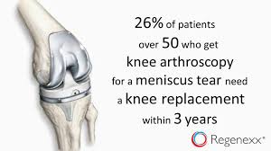 Knee Arthroscopy Alternatives Knee Arthroscopy Meniscus Tear Knee Replacement