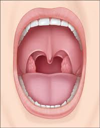 Image result for Tonsillitis