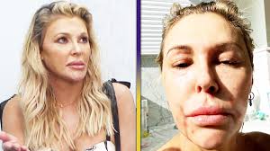Adrienne Maloof Regrets Not Attending The Rhobh Season 3 Reunion | Life  After Bravo - Youtube