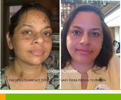 Top Herbal Slimming Capsule Retailers in Vile Parle East