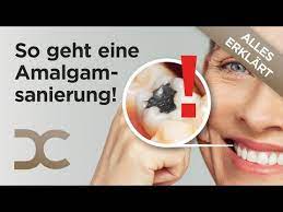 Check spelling or type a new query. Amalgamsanierung Amalgamfullungen Sicher Entfernen Dorow Clinic