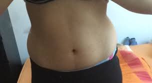 Wiege dich nur mit einer fett analyse waage. Verliert Man Sein Fett Und Gewicht Nach Der Pubertat Wieder Bauch