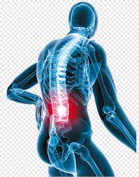 Neck pain back of neck anatomy. Low Back Pain Neck Pain Oxycodone Human Back Vertebral Pain Electric Blue Png Pngegg