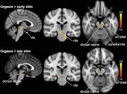 Lower brainstem regions activated during orgasm. Top panel shows orgasm...  | Download Scientific Diagram