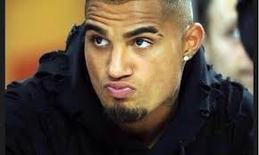 It would be very simple for him to remove the stripe of hair and go with a completely bald look. K P Boateng Reveals It All In This Interview I Accept The Suspension But 233times