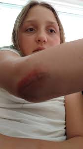 Skates! Left close to the playground.