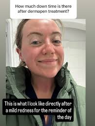 Clíodhna Hegarty RN (@aesthetic_nurse_cli) • Instagram photos and videos