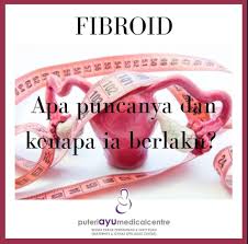 Muhammad izzat, seorang pegawai perubatan kesihatan. Fibroid Apa Itu Fibroid Kenapa Berlakunya Fibroid Apa Tanda Tanda Fibroid Inginkan Penerangan Dan Pemeriksaan Lanjut Jom Temui Pakar Sakit Puan Kami Di Puteri Ayu Medical Centre Kami Sedia Membantu Anda
