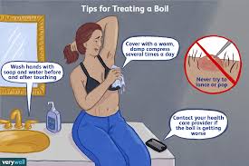 Their disgusting and very painful. Skin Boil First Aid Treatment