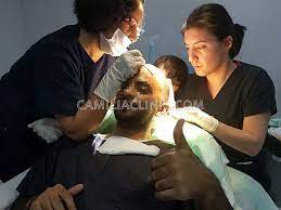 صور ملتقطة اثناء عمليات زراعة الشعر في مركز كاميليا كلينك لزراعة الشعر في تركيا 00905444488340 www camiliaclinic com hair transplant hairstyles p