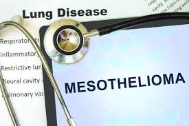 Despite this, pancreatic cancer is among the deadliest types of cancer, which is why it's extremely important to know and recogni. What Is Mesothelioma Cancer Caused From Lung Cancer Pintas Mullins Law Firm