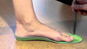Properly Sizing Superfeet Premium Non Custom Insoles From San Francisco Podiatrist