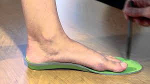 properly sizing superfeet premium non custom insoles from san francisco podiatrist