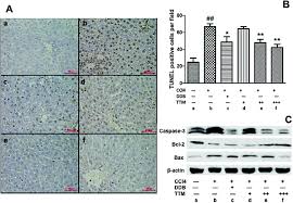 With one marketplace, you can buy and sell confidently and efficiently — through channels that make sense for your business. Protective Effect Of Trillium Tschonoskii Saponin On Ccl4 Induced Acute Liver Injury Of Rats Through Apoptosis Inhibition