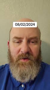V 3mn Brunson Case 2024