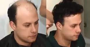 Amazing Challenge With Hair Toupee Hair System Men S Wig Hair Toupee Mens Wigs Hair System