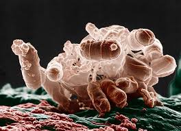 Learn and reinforce your understanding of listeria monocytogenes through video. Forschen Stimmungsmache Spiegel Online Antimicrobial Resistance Microbiology Gut Microbiota