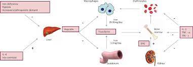 Anaemia Of Chronic Disease Rcp Journals
