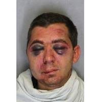 1 Man Arrested, 3 Injured In Champaign Fight