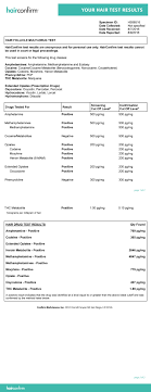 28 Albums Of Hair Follicle Drug Test Results Levels