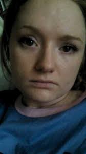 Life in a Taylor Spatial Frame…1 month down