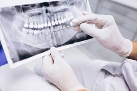 Meskipun perubahan warna gigi atau gigi kuning sulit dihindari, tetap ada cara untuk mengembalikan warna putih alami gigi. Jenis Braces 2021 Panduan Sebelum Memakai Braces Policystreet