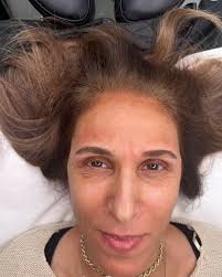 נטף לוי-מיקרובליידינג גבות שפתיים‎