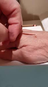 japanese acupuncture clinic berlin home facebook