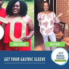 Gastric sleeve surgery is an inpatient procedure performed by a bariatric surgeon in a hospital or surgical center under general anesthesia. Gastric Sleeve Before And After Pictures Best Vsg Photos 2021
