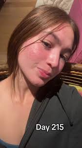 skin journey (@skin.journey4)'s videos with original sound