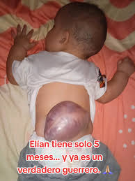 Apoya a Elían: un pequeño guerrero necesita tu ayuda