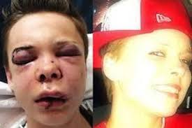 Mallory Owens' attacker Travis Hawkins Jr now faces potential attempted  murder charges.