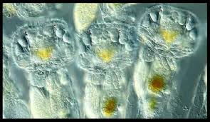 Image result for Microcoelia physophora
