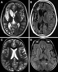 In simple terms, an mri scanner consists of a large. Examples Of Magnetic Resonance Imaging Mri Scans From Patients With Download Scientific Diagram
