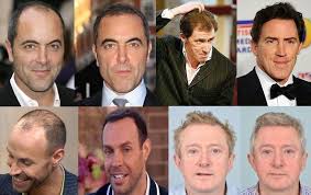 Did you spot a celebrity with a hair emergency? And The Award Goes To Celebrity Hair Transplants Your Questions Answered