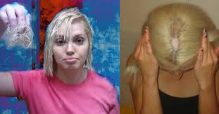 I have had alopecia for about 4 months and i am going crazy as i keep myself from coloring it as i usually do. 15 Pics Of Hair Bleach Gone Very Wrong Thetalko