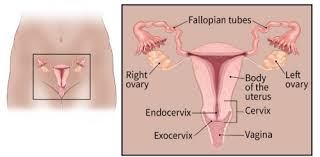 If You Have Ovarian Cancer Ovarian Cancer Facts